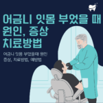 어금니 잇몸 부었을 때 원인, 증상, 치료 방법, 그리고 예방법